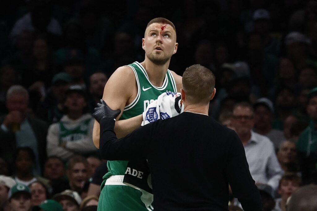 Celtics center Kristaps Porzingis is treated after taking an elbow to the forehead.